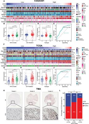 Transcriptome profile and clinical characterization of ICOS expression in gliomas